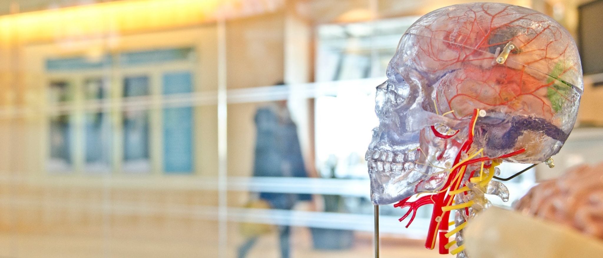Traumatic Brain Injuries and Car Accidents